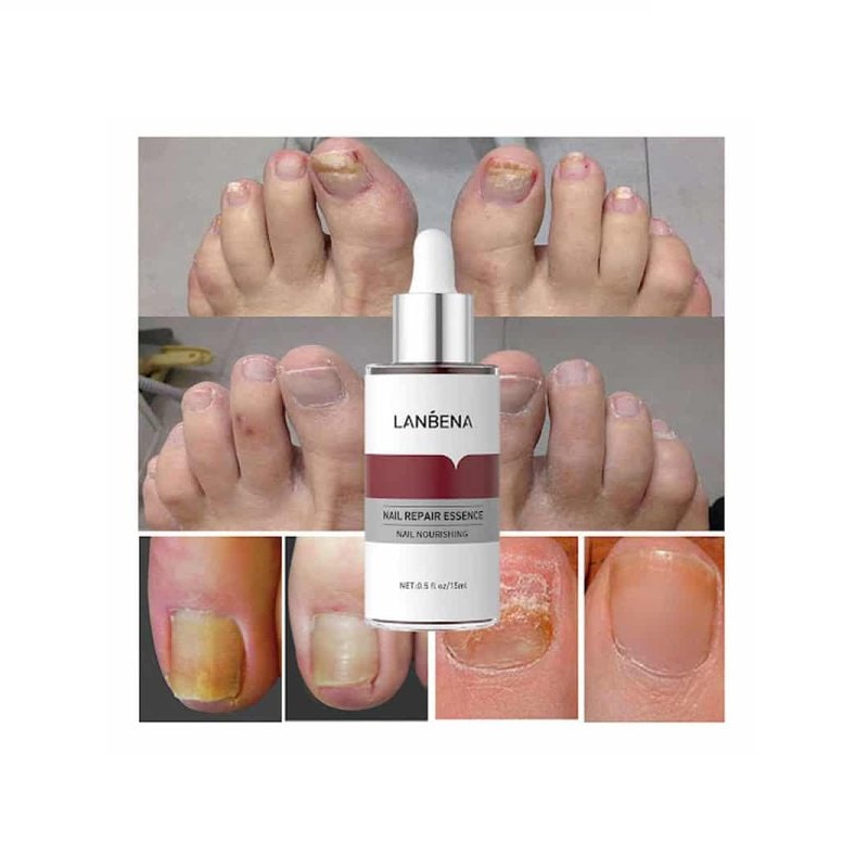 سرم تقویت کننده ناخن مدل LANBENA-چند رنگ